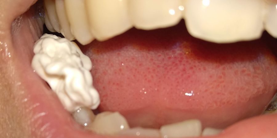 Sleeping with a Gum in Your Mouth?