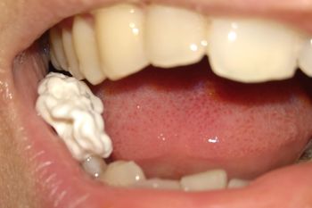 Is It Bad to Sleep with a Gum in Your Mouth? Swallowing Gum?